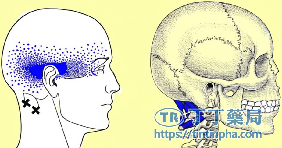 哪些情況的「麻感」屬於正常? 哪些情況的「麻感」屬於正常?
